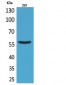 CD276 Polyclonal Antibody