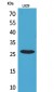 CD159a/c Polyclonal Antibody