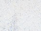 CDCP1 Polyclonal Antibody