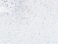 CDCP1 Polyclonal Antibody