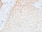 VEGF-C Polyclonal Antibody