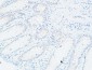 VEGF-C Polyclonal Antibody