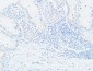 VEGF-C Polyclonal Antibody