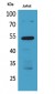 BMP-3A Polyclonal Antibody