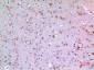 ARP Polyclonal Antibody