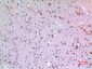 ARP Polyclonal Antibody