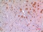 ARP Polyclonal Antibody