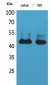 SCCA1/2 Polyclonal Antibody