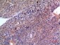 SCCA1/2 Polyclonal Antibody