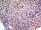 SCCA1/2 Polyclonal Antibody