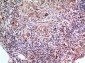 SCCA1/2 Polyclonal Antibody