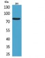 Bcl-6 Polyclonal Antibody