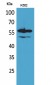 Lyn Polyclonal Antibody