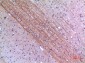 Lyn Polyclonal Antibody