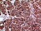 Amphiphysin II Polyclonal Antibody