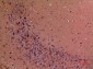 GDI-2 Polyclonal Antibody