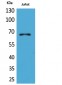 ERα Polyclonal Antibody