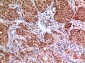 EPAS-1 Polyclonal Antibody