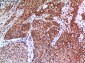 EPAS-1 Polyclonal Antibody