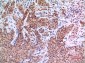 EPAS-1 Polyclonal Antibody