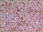 HSP 90 Polyclonal Antibody