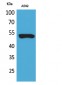 Cytokeratin 8 Polyclonal Antibody