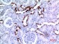 Cytokeratin 8 Polyclonal Antibody