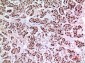 KLF13 Polyclonal Antibody