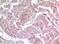 Ku-70 Polyclonal Antibody