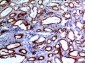 Ku-70 Polyclonal Antibody