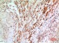 NFκB-p65 Polyclonal Antibody