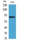 NFκB-p65 Polyclonal Antibody