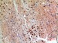 NFκB-p65 Polyclonal Antibody