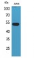 p53 Polyclonal Antibody