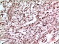 p53 Polyclonal Antibody