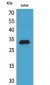 p57 Polyclonal Antibody