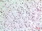 p57 Polyclonal Antibody