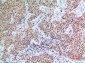 p57 Polyclonal Antibody