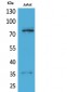 p73 Polyclonal Antibody