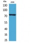 p73 Polyclonal Antibody