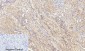 IL-6 Polyclonal Antibody