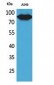 CD10 Polyclonal Antibody