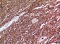 CD10 Polyclonal Antibody