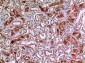 CD10 Polyclonal Antibody