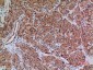 Amphiphysin II Polyclonal Antibody