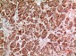 HPA1 Polyclonal Antibody