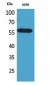 ALDH2 Polyclonal Antibody