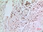 MMP-9 Polyclonal Antibody