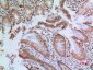 MMP-9 Polyclonal Antibody