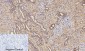 MMP-9 Polyclonal Antibody